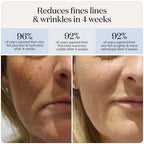 Red light therapy LED Mask - image 2